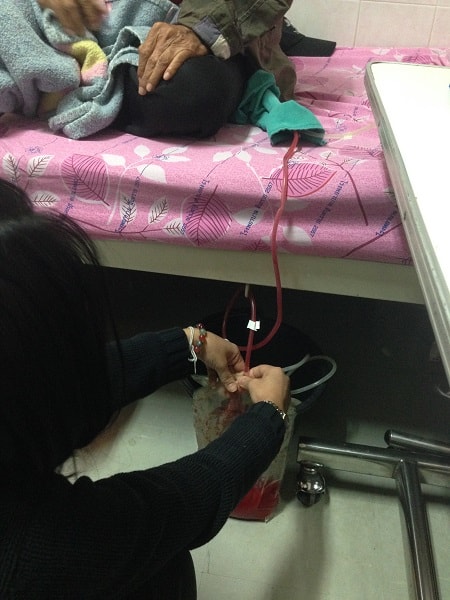 Pic 5. A patient's family member is changing a dialysis bag. / Photo: B.K. Seo.