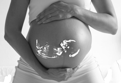 Pregnant woman. Source: Pexels.